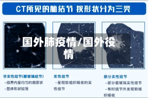 国外肺疫情/国外役情